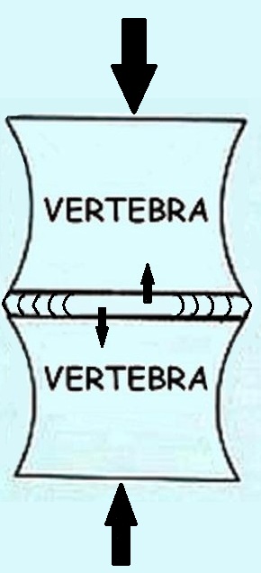 vertebrae compression