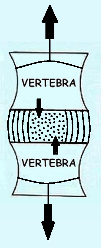 vertebrae decompression